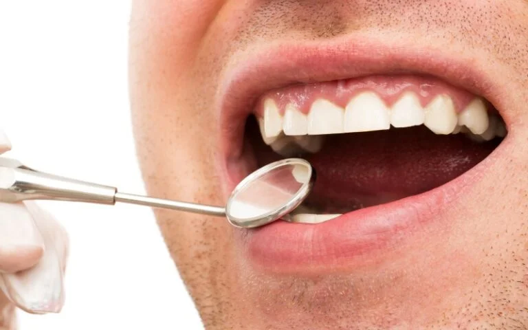 Teeth Scaling & Polishing Services - Sinaran Dental Clinic