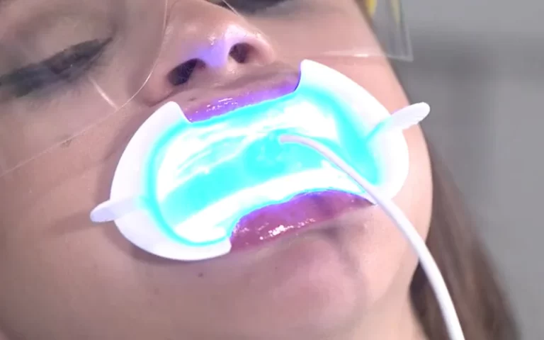 Teeth Whitening Clinic Malaysia - Sinaran Dental Clinic